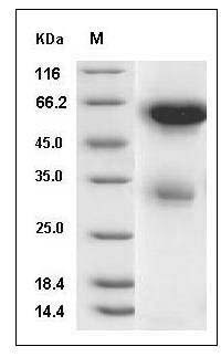 Mouse Legumain/ LGMN Protein (His Tag) SDS-PAGE
