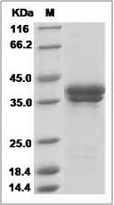 Rhesus IL17A & IL17F Heterodimer Protein (His Tag)