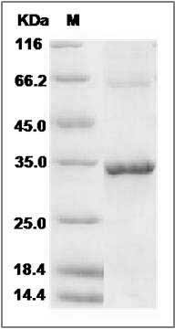 Human NMNAT1 / NMNAT Protein (His Tag) SDS-PAGE