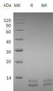 Mouse Cxcl1/Gro/Gro1/Mgsa/Scyb1 (His tag) recombinant protein