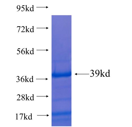 Recombinant human CCDC101(Full length) SDS-PAGE