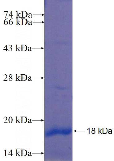 Recombinant Human CD164L2 SDS-PAGE
