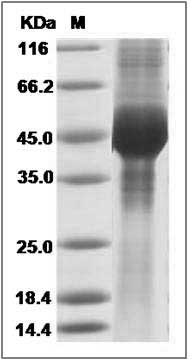 Mouse GFRA3 / GFR-alpha-3 Protein (His Tag) SDS-PAGE