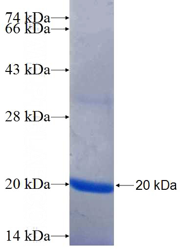 Recombinant Human C16orf62 SDS-PAGE
