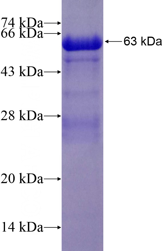 Recombinant Human GNAI2 SDS-PAGE