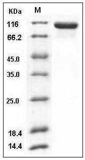 Human Tie2 / CD202b / TEK Protein (His Tag) SDS-PAGE
