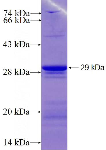 Recombinant Human ATP1B4 SDS-PAGE