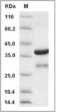Human BLOC1S2 / BLOS2 Protein (GST Tag) SDS-PAGE