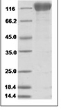 Human VEGFR2/KDR/Flk-1/CD309 Protein 15481