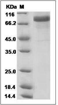 Human / Rhesus HER4 / ErbB4 Protein (His Tag) SDS-PAGE