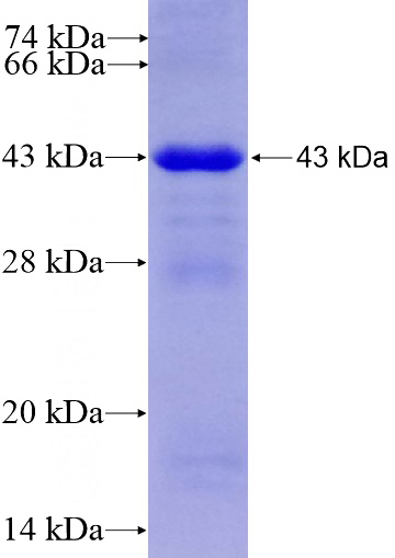 Human SLC25A12 Recombinant protein (6*His tag)