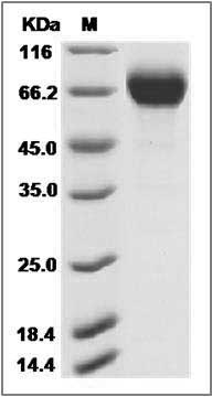 Influenza A H7N9 (A/Shanghai/1/2013) Neuraminidase / NA (His Tag) SDS-PAGE