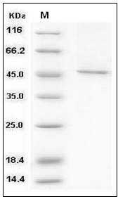 Human SMYD3 / ZMYND1 Protein (His & FLAG Tag) SDS-PAGE