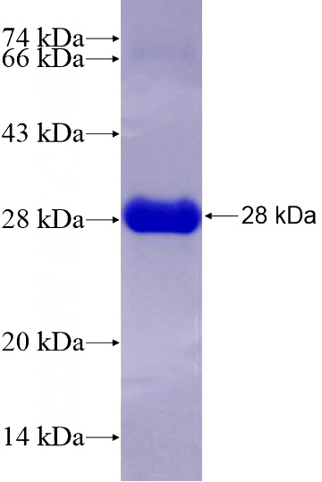 Recombinant Human PPP1CA SDS-PAGE