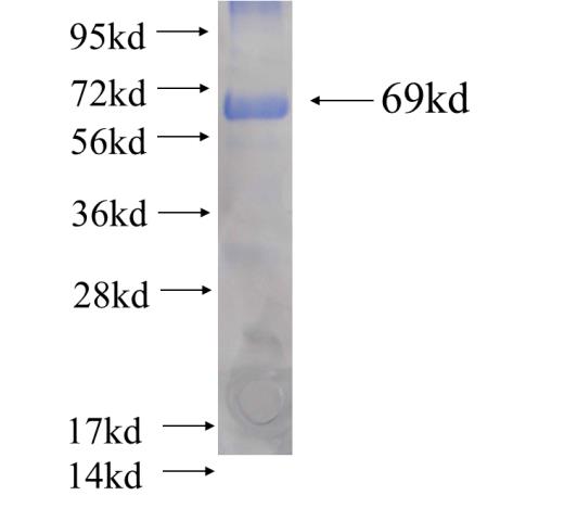 Recombinant human TTL(Full length) SDS-PAGE