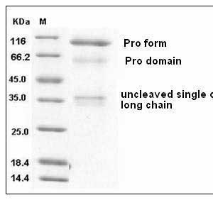 Human HGFA Protein (His Tag) SDS-PAGE
