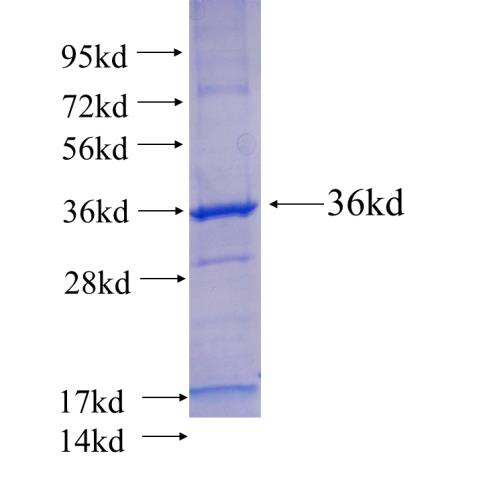 Recombinant human RPL7A(Full length) SDS-PAGE