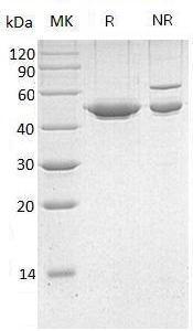 Human SERPINE1/PAI1/PLANH1 (His tag) recombinant protein