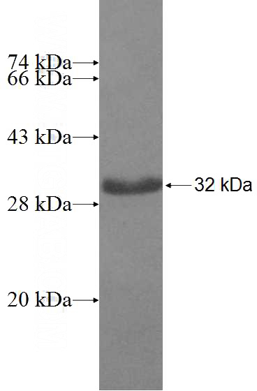 Recombinant Human CHMP1A SDS-PAGE