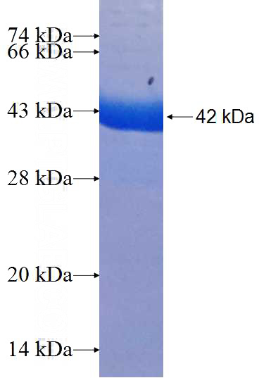 Recombinant Human GARS SDS-PAGE