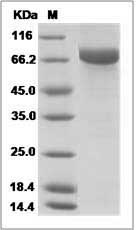 Influenza A H3N2 (A/Victoria/210/2009) Hemagglutinin / HA Protein (His Tag)