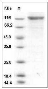 Human TLK1 / PKU-beta Protein (His & GST Tag) SDS-PAGE