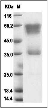 Cynomolgus EDAR Protein (Fc Tag) SDS-PAGE
