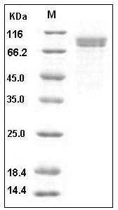 Human Cadherin-8 / CDH8 Protein (His Tag) SDS-PAGE