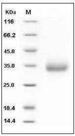 Mouse VSIG4 Protein (His Tag) SDS-PAGE