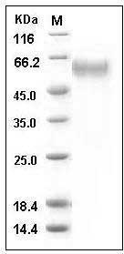 Mouse sFRP4 Protein (His Tag) SDS-PAGE