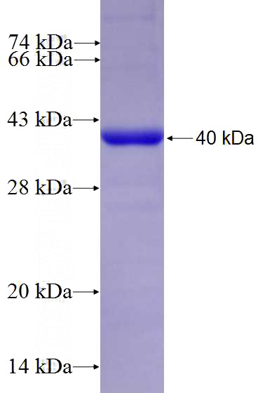 Recombinant Human LRRC49 SDS-PAGE