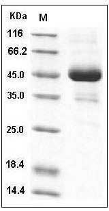 Mouse ALK-2 / ACVR1 Protein (His & Fc Tag) SDS-PAGE