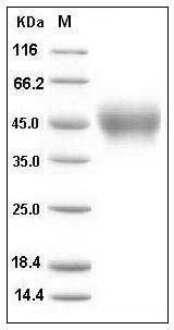 Human IL4R / CD124 Protein (His Tag) SDS-PAGE