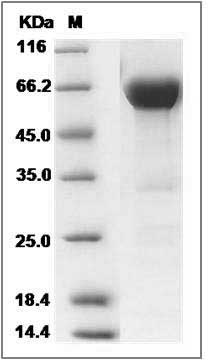 Human VSIG4 Protein (Fc Tag) SDS-PAGE