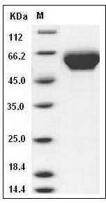 Human LILRB3 / LIR3 / ILT5 / CD85a Protein (His Tag) SDS-PAGE
