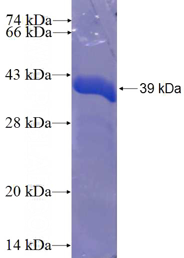 Recombinant Human CCDC21 SDS-PAGE