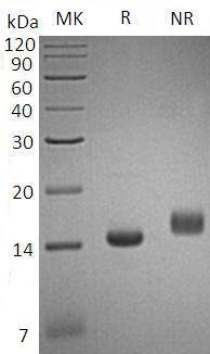 Human CCL3L1/D17S1718/G0S19-2 (His tag) recombinant protein