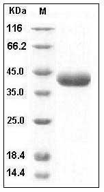 Human Prostasin / Prss8 Protein (His Tag) SDS-PAGE