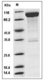 Mouse CD6 / TP120 Protein (Fc Tag) SDS-PAGE