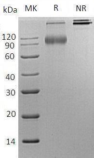 Human CD200R1/CD200R/CRTR2 (Fc tag) recombinant protein