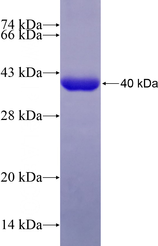 Recombinant Human PDCL SDS-PAGE