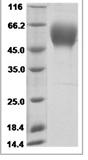 Human KDR recombinant protein (C-His)