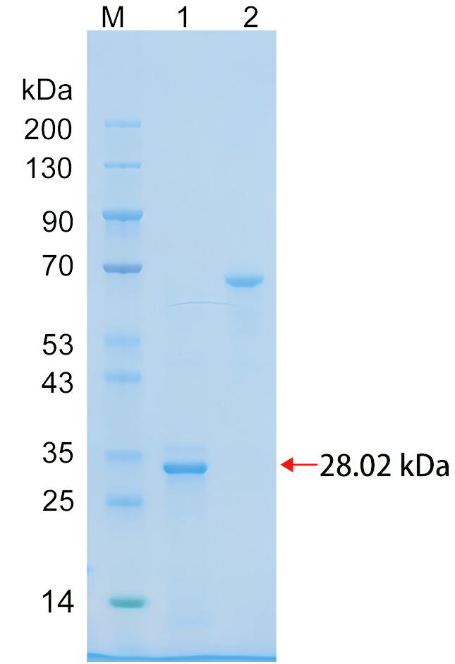 Recombinant EGLN2 protein (His tag) SDS-PAGE