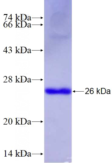 Recombinant Human WNT3 SDS-PAGE