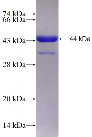 Recombinant Human BRSK2 SDS-PAGE