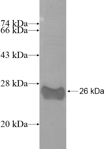 Recombinant Human RTP2 SDS-PAGE