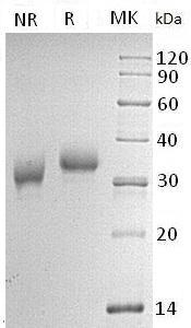 Human CD2/SRBC (His tag) recombinant protein