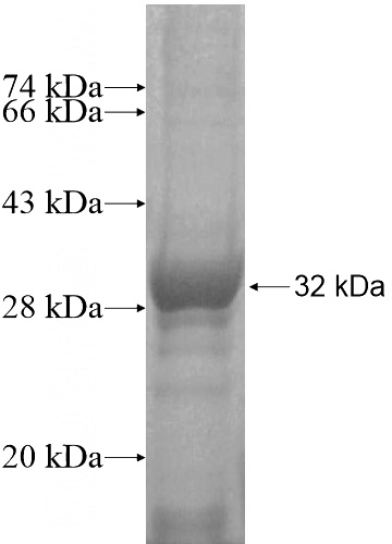 Recombinant Human C3orf75 SDS-PAGE