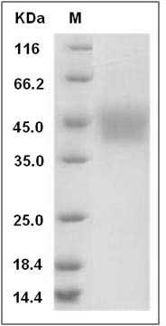Rat IL-21R / Interleukin-21 Receptor Protein (His Tag) SDS-PAGE