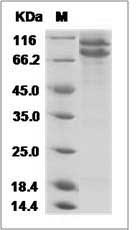 Human E-Cadherin / CDH1 / E-cad / CD324 Protein (His Tag)